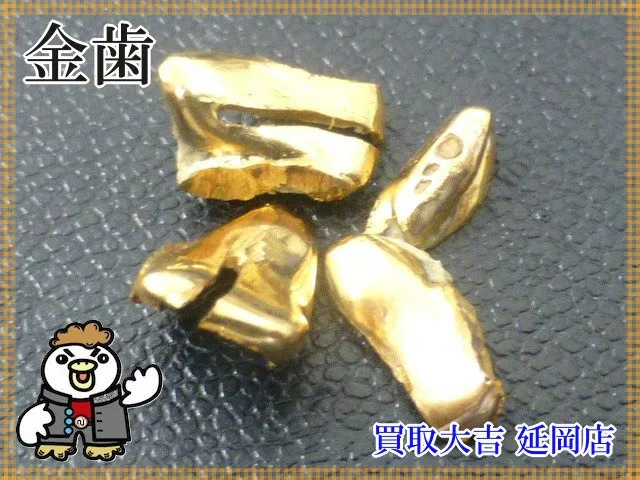 金歯